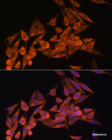 Immunofluorescence analysis of HeLa cells using PTEN Polyclonal Antibody at dilution of 1:100. Blue: DAPI for nuclear staining.