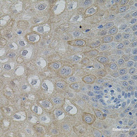 Immunohistochemistry of paraffin-embedded Human esophagus using FAK Polyclonal Antibody at dilution of 1:100 (40x lens) .