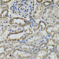 Immunohistochemistry of paraffin-embedded Rat kidney using PTPRC Polyclonal Antibody