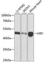 Western blot analysis of extracts of various cell lines using LKB1 Polyclonal Antibody at dilution of 1:1000.