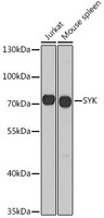 Western blot analysis of extracts of various cell lines using SYK Polyclonal Antibody at dilution of 1:1000.