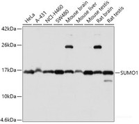 Western blot analysis of extracts of various cell lines using SUMO1 Polyclonal Antibody at dilution of 1:1000.