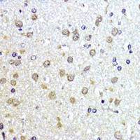 Immunohistochemistry of paraffin-embedded Rat brain using SUMO1 Polyclonal Antibody at dilution of 1:200 (40x lens) .