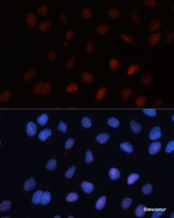 Immunofluorescence analysis of U-2 OS cells using SUMO1 Polyclonal Antibody at dilution of 1:100. Blue: DAPI for nuclear staining.
