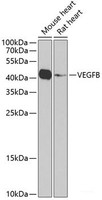 Western blot analysis of extracts of various cell lines using VEGFB Polyclonal Antibody at dilution of 1:1000.