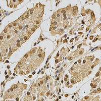 Immunohistochemistry of paraffin-embedded Human stomach using XRCC3 Polyclonal Antibody at dilution of 1:200 (40x lens) .