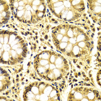 Immunohistochemistry of paraffin-embedded Human colon using XRCC3 Polyclonal Antibody at dilution of 1:100 (40x lens) .