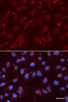 Immunofluorescence analysis of U2OS cells using XRCC3 Polyclonal Antibody