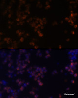 Immunofluorescence analysis of Raw264.7 cells using ZYX Polyclonal Antibody at dilution of 1:100. Blue: DAPI for nuclear staining.