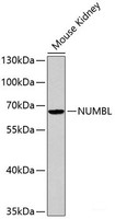 Western blot analysis of extracts of Mouse kidney cells using NUMBL Polyclonal Antibody.