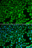 Immunofluorescence analysis of U2OS cells using NDRG1 Polyclonal Antibody