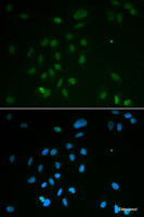 Immunofluorescence analysis of MCF-7 cells using CHEK2 Polyclonal Antibody