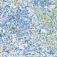 Immunohistochemistry of paraffin-embedded Rat spleen using Caspase-3 Polyclonal Antibody at dilution of 1:100 (40x lens) .