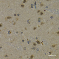 Immunohistochemistry of paraffin-embedded Rat brain using MAX Polyclonal Antibody at dilution of 1:200 (40x lens) .