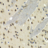 Immunohistochemistry of paraffin-embedded Mouse brain using MAX Polyclonal Antibody at dilution of 1:200 (40x lens) .