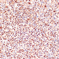 Immunohistochemistry of paraffin-embedded Human tonsil using ALOX5 Polyclonal Antibody at dilution of 1:100 (40x lens) .