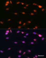 Immunofluorescence analysis of C6 cells using ALOX5 Polyclonal Antibody at dilution of 1:100. Blue: DAPI for nuclear staining.