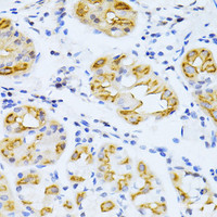 Immunohistochemistry of paraffin-embedded Human stomach using CYP2E1 Polyclonal Antibody at dilution of 1:100 (40x lens) .