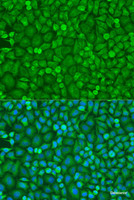 Immunofluorescence analysis of U2OS cells using EIF4E Polyclonal Antibody at dilution of 1:100. Blue: DAPI for nuclear staining.