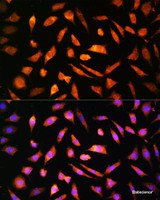 Immunofluorescence analysis of L929 cells using BNP Polyclonal Antibody at dilution of 1:100. Blue: DAPI for nuclear staining. Immunofluorescence analysis of L929 cells using BNP Polyclonal Antibody at dilution of 1:100. Blue: DAPI for nuclear staining.