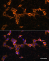 Immunofluorescence analysis of NIH/3T3 cells using PDGFR beta Polyclonal Antibody at dilution of 1:100. Blue: DAPI for nuclear staining.