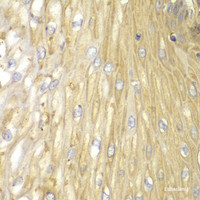 Immunohistochemistry of paraffin-embedded Human esophagus using PPP2R2A Polyclonal Antibody at dilution of 1:100 (40x lens) .