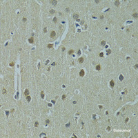 Immunohistochemistry of paraffin-embedded Rat brain using UBE2I Polyclonal Antibody at dilution of 1:100 (40x lens) .