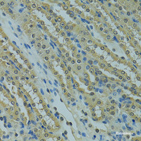 Immunohistochemistry of paraffin-embedded Mouse kidney using UBE2I Polyclonal Antibody at dilution of 1:100 (40x lens) .