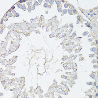 Immunohistochemistry of paraffin-embedded Rat testis using MRP4 / ABCC4 Polyclonal Antibody at dilution of 1:150 (40x lens) .