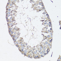 Immunohistochemistry of paraffin-embedded Mouse testis using MRP4 / ABCC4 Polyclonal Antibody at dilution of 1:150 (40x lens) .