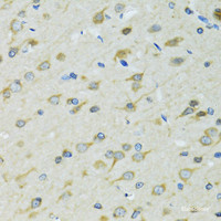 Immunohistochemistry of paraffin-embedded Rat brain using DCTN2 Polyclonal Antibody at dilution of 1:100 (40x lens) .