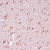 Immunohistochemistry of paraffin-embedded Rat brain using TOLLIP Polyclonal Antibody at dilution of 1:100 (40x lens) .