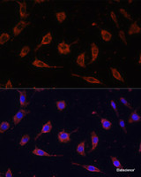 Immunofluorescence analysis of L929 cells using TOLLIP Polyclonal Antibody at dilution of 1:100. Blue: DAPI for nuclear staining.