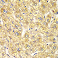 Immunohistochemistry of paraffin-embedded Human liver damage using OGT Polyclonal Antibody at dilution of 1:100 (40x lens) .