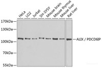 Western blot analysis of extracts of various cell lines using ALIX / PDCD6IP Polyclonal Antibody at dilution of 1:1000.