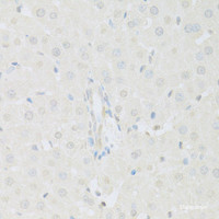 Immunohistochemistry of paraffin-embedded Rat liver using KAT2A Polyclonal Antibody at dilution of 1:100 (40x lens) .