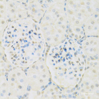 Immunohistochemistry of paraffin-embedded Rat kidney using KAT2A Polyclonal Antibody at dilution of 1:100 (40x lens) .