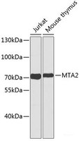 Western blot analysis of extracts of various cell lines using MTA2 Polyclonal Antibody.