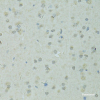 Immunohistochemistry of paraffin-embedded Rat brain using TRIM28 Polyclonal Antibody at dilution of 1:100 (40x lens) .