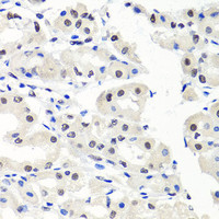 Immunohistochemistry of paraffin-embedded Human stomach using CBX1 Polyclonal Antibody at dilution of 1:100 (40x lens) .