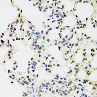 Immunohistochemistry of paraffin-embedded Mouse lung using EDF1 Polyclonal Antibody at dilution of 1:100 (40x lens) .