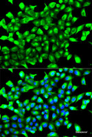 Immunofluorescence analysis of MCF-7 cells using EGLN1 Polyclonal Antibody