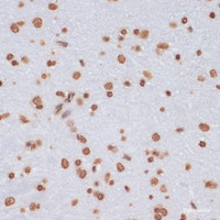 Immunohistochemistry of paraffin-embedded Rat brain using Histone H3 Polyclonal Antibody at dilution of 1:100 (40x lens) .