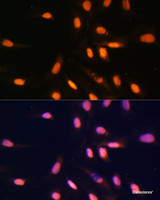 Immunofluorescence analysis of U-2 OS cells using MonoMethyl-Histone H3-K4 Polyclonal Antibody at dilution of 1:100. Blue: DAPI for nuclear staining.