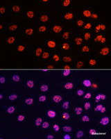 Immunofluorescence analysis of HeLa cells using DiMethyl-Histone H3-K4 Polyclonal Antibody at dilution of 1:100. Blue: DAPI for nuclear staining.