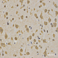 Immunohistochemistry of paraffin-embedded Rat brain using TriMethyl-Histone H3-K4 Polyclonal Antibody at dilution of 1:200 (40x lens) .