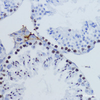 Immunohistochemistry of paraffin-embedded Mouse testis using TriMethyl-Histone H3-K9 Polyclonal Antibody at dilution of 1:200 (40x lens) .
