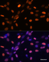 Immunofluorescence analysis of NIH/3T3 cells using TriMethyl-Histone H3-K27 Polyclonal Antibody at dilution of 1:100. Blue: DAPI for nuclear staining.