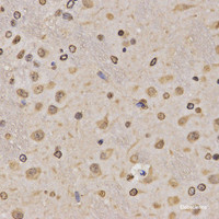 Immunohistochemistry of paraffin-embedded Rat brain using MonoMethyl-Histone H3-K36 Polyclonal Antibody at dilution of 1:200 (40x lens) .