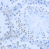 Immunohistochemistry of paraffin-embedded Mouse testis using DiMethyl-Histone H3-K36 Polyclonal Antibody at dilution of 1:200 (40x lens) .